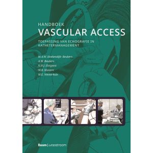 Handboek vascular access