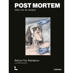 Post mortem